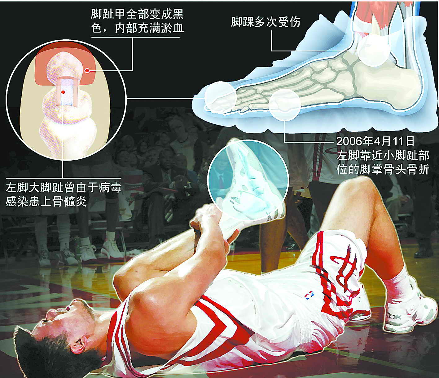 Doinb连续二十场比赛得分超过赛况扑朔迷离，老鹰挑战极限！